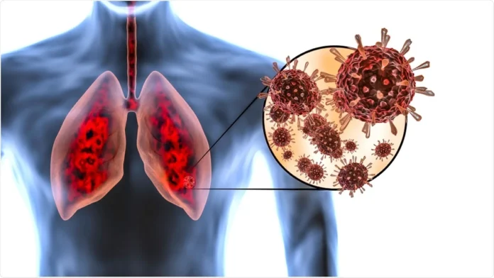 Lung Damage
